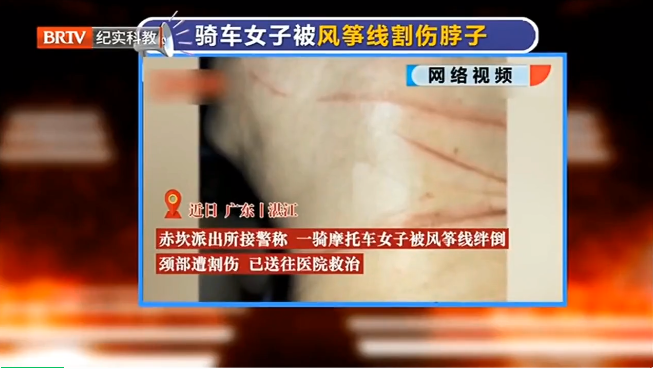 京云<a href=http://m.shengmiao.com.cn/team/ target=_blank class=infotextkey>律師</a>解讀：危險！女子騎車脖子遭風箏線割傷，放飛者應為此擔責！